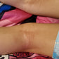 Eczneaux Eczema and Psoriasis Body Butter